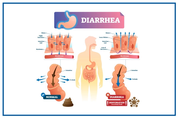 Diarrhea Awareness